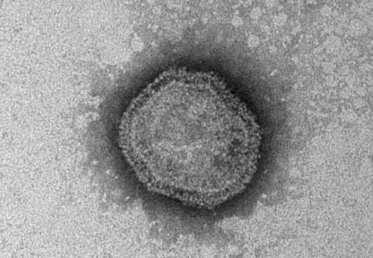 パラインフルエンザウイルス：何を心配すべきでしょうか?