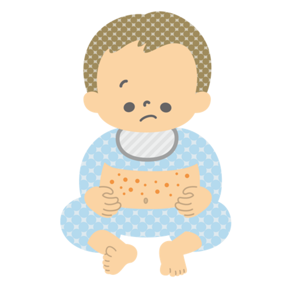 突発性発疹は、どういう病気？